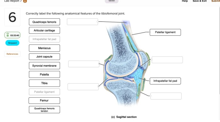 Label elbow joint anatomical features following correctly capsule ligament anterior solved transcribed problem text been show has humerus