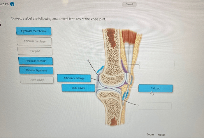 Correctly label the following anatomical features of the knee joint.