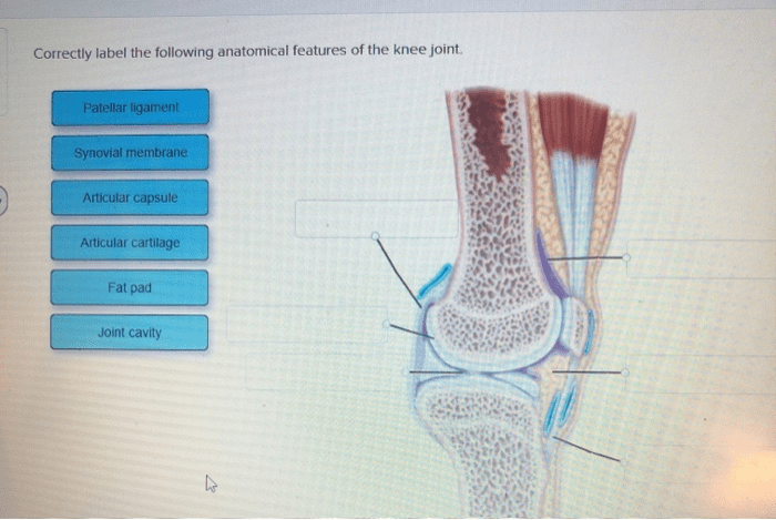 Correctly label the following anatomical features of the knee joint.