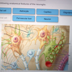 Correctly anatomical tibiofemoral